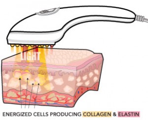 cross_section_basic